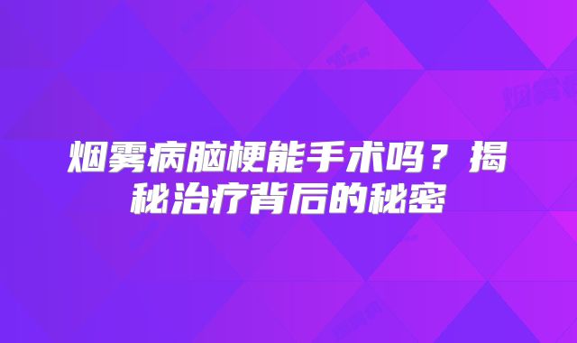 烟雾病脑梗能手术吗？揭秘治疗背后的秘密