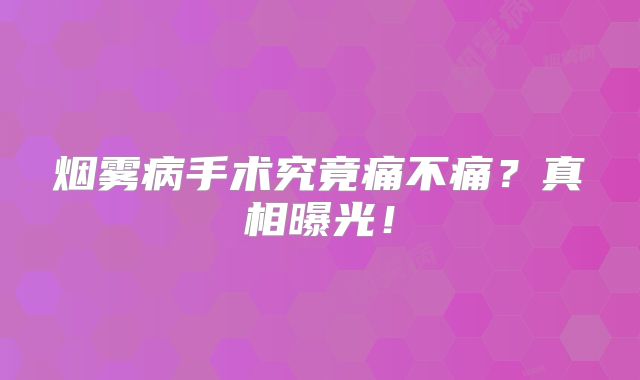 烟雾病手术究竟痛不痛？真相曝光！