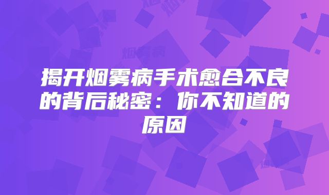 揭开烟雾病手术愈合不良的背后秘密：你不知道的原因