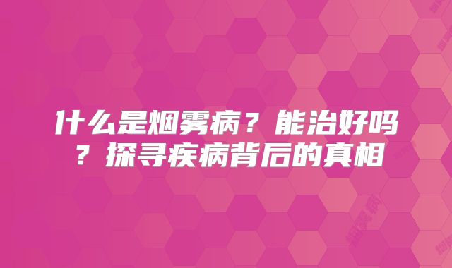 什么是烟雾病？能治好吗？探寻疾病背后的真相