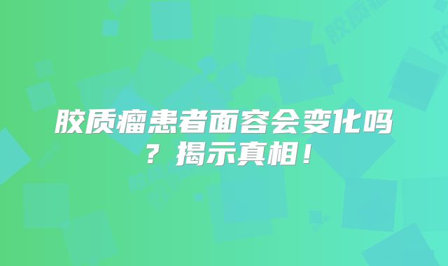 胶质瘤患者面容会变化吗？揭示真相！