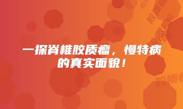 一探脊椎胶质瘤，慢特病的真实面貌！