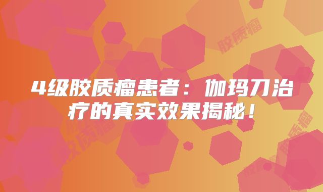 4级胶质瘤患者：伽玛刀治疗的真实效果揭秘！