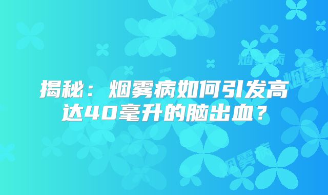 揭秘：烟雾病如何引发高达40毫升的脑出血？