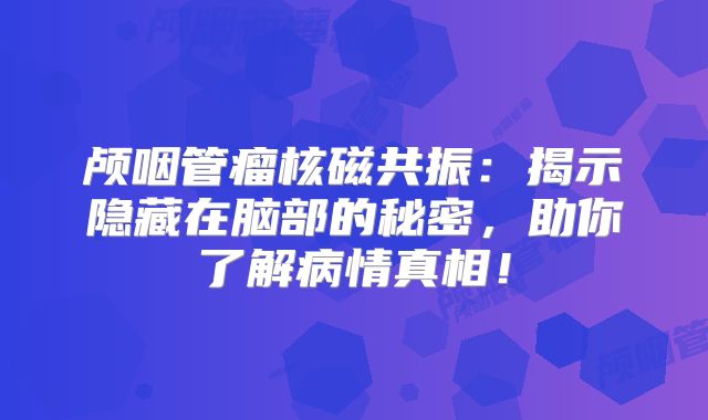 颅咽管瘤核磁共振：揭示隐藏在脑部的秘密，助你了解病情真相！