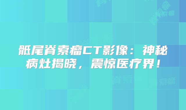 骶尾脊索瘤CT影像：神秘病灶揭晓，震惊医疗界！