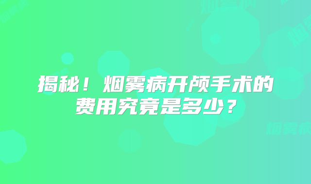 揭秘！烟雾病开颅手术的费用究竟是多少？