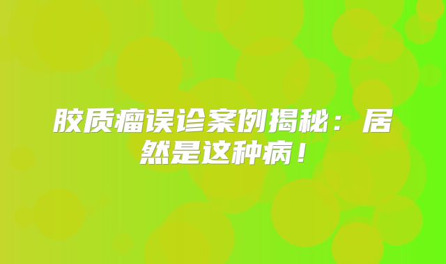胶质瘤误诊案例揭秘：居然是这种病！