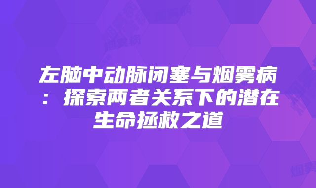 左脑中动脉闭塞与烟雾病：探索两者关系下的潜在生命拯救之道