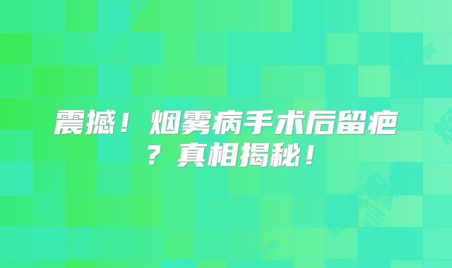 震撼！烟雾病手术后留疤？真相揭秘！