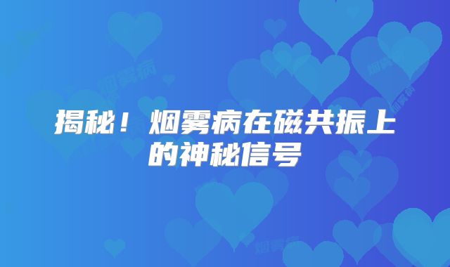 揭秘！烟雾病在磁共振上的神秘信号