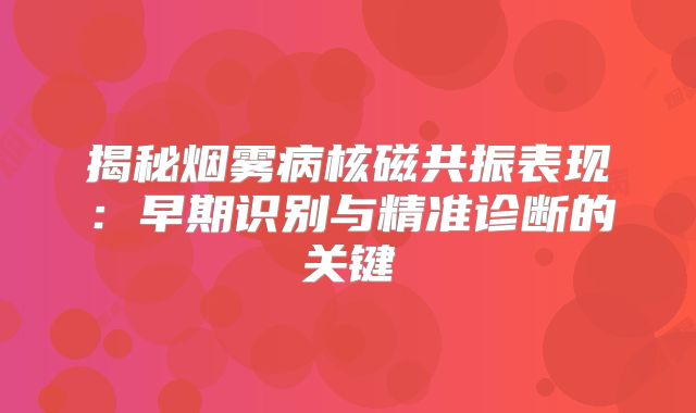揭秘烟雾病核磁共振表现：早期识别与精准诊断的关键