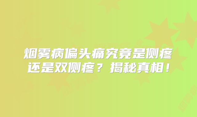烟雾病偏头痛究竟是侧疼还是双侧疼？揭秘真相！