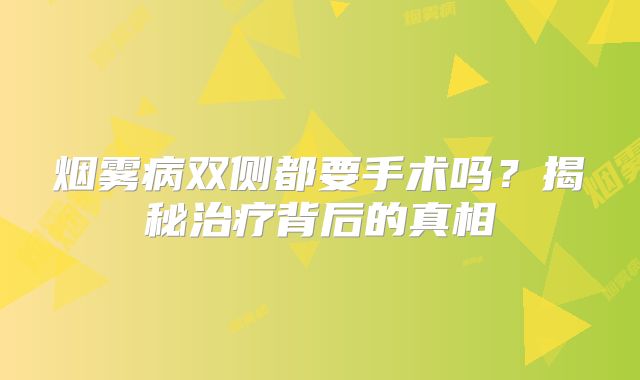 烟雾病双侧都要手术吗？揭秘治疗背后的真相