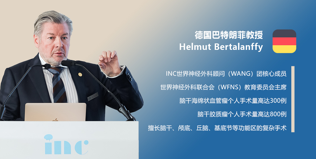 胶质母细胞瘤是成人最常见的不可治愈的原发性恶性脑瘤