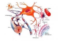 【胶质瘤症状】常见的胶质瘤症状的类型