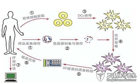 <b>中医能不能治疗胶质瘤?</b>