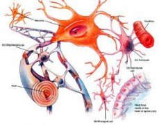 【胶质瘤症状】不同类型的胶质瘤有什么症状？